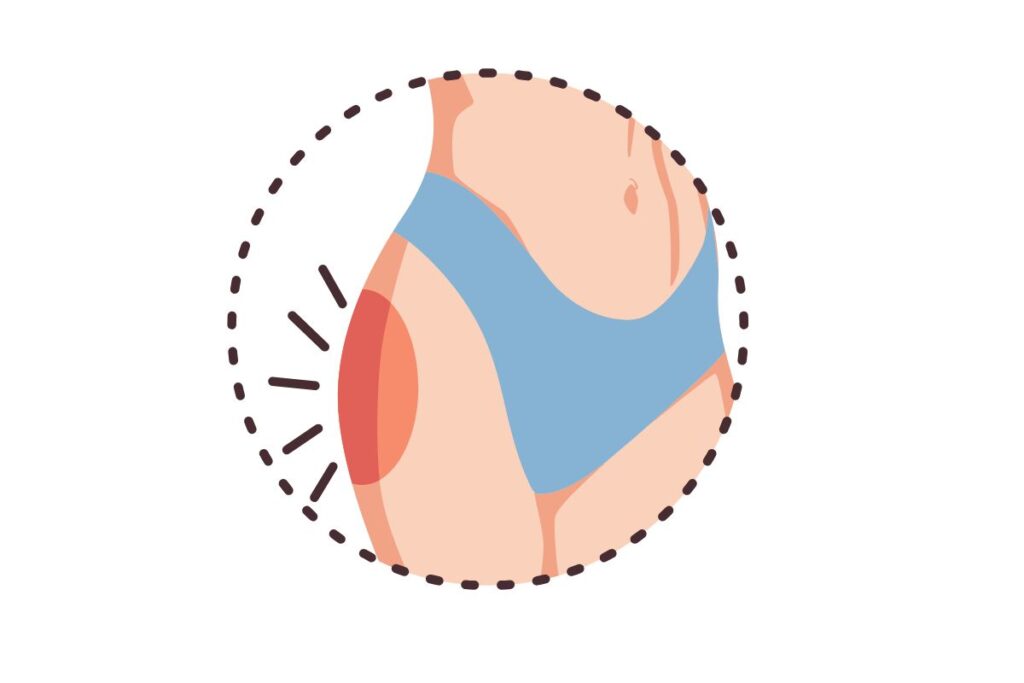Tenseur du Fascia Lata